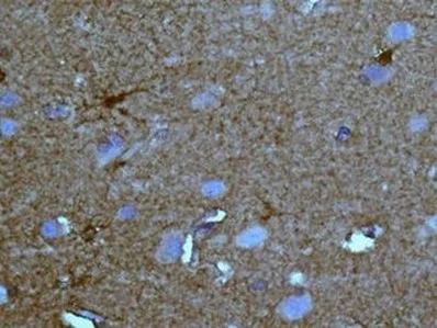 Immunohistochemistry (Formalin/PFA-fixed paraffin-embedded sections) - Anti-NDRG3 antibody [EPR9011(B)] (AB133715)