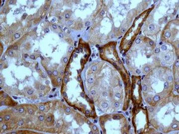 Immunohistochemistry (Formalin/PFA-fixed paraffin-embedded sections) - Anti-NDRG3 antibody [EPR9011(B)] (AB133715)
