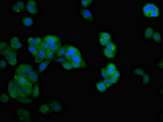 Immunocytochemistry/ Immunofluorescence - Anti-NDRG4 antibody (AB237052)