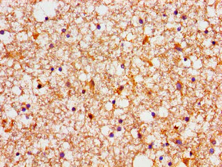 Immunohistochemistry (Formalin/PFA-fixed paraffin-embedded sections) - Anti-NDRG4 antibody (AB237052)