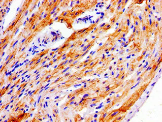 Immunohistochemistry (Formalin/PFA-fixed paraffin-embedded sections) - Anti-NDRG4 antibody (AB237052)