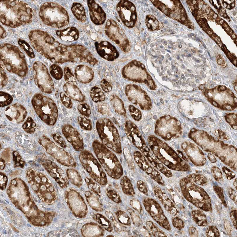 Immunohistochemistry (Formalin/PFA-fixed paraffin-embedded sections) - Anti-NDUF3 antibody (AB122270)