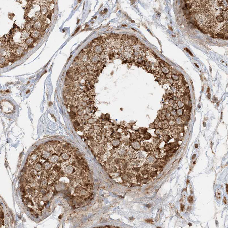 Immunohistochemistry (Formalin/PFA-fixed paraffin-embedded sections) - Anti-NDUF3 antibody (AB122270)