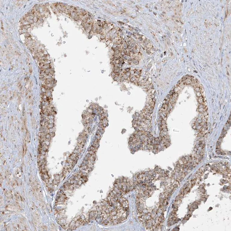 Immunohistochemistry (Formalin/PFA-fixed paraffin-embedded sections) - Anti-NDUF3 antibody (AB122270)