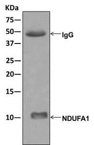 Immunoprecipitation - Anti-NDUFA1 antibody [EPR12083] - BSA and Azide free (AB249923)