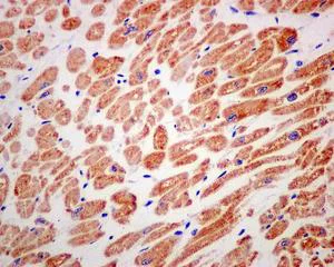 Immunohistochemistry (Formalin/PFA-fixed paraffin-embedded sections) - Anti-NDUFA10 antibody [EPR12135] (AB174829)