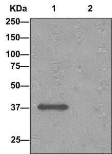 Immunoprecipitation - Anti-NDUFA10 antibody [EPR12135] (AB174829)