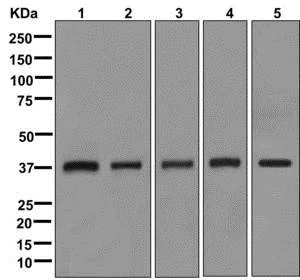 Western blot - Anti-NDUFA10 antibody [EPR12135] (AB174829)