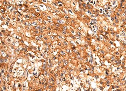 Immunohistochemistry (Formalin/PFA-fixed paraffin-embedded sections) - Anti-NDUFA2 antibody (AB198196)
