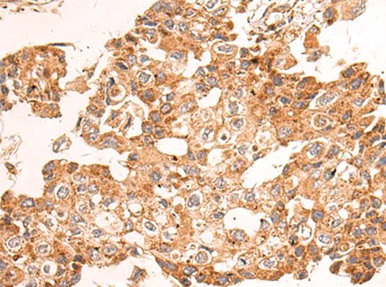 Western blot - Anti-NDUFA2 antibody (AB198196)