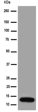 Western blot - Anti-NDUFA5 antibody [EPR15330] (AB183706)