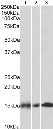 Western blot - Anti-NDUFA7 antibody (AB140871), expandable thumbnail