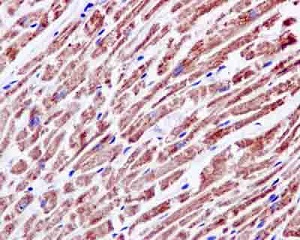 Immunohistochemistry (Formalin/PFA-fixed paraffin-embedded sections) - Anti-NDUFAB1 antibody [EPR6725] (AB181021)