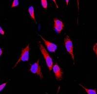 Immunocytochemistry/ Immunofluorescence - Anti-NDUFAF1 antibody [EPR2795] - BSA and Azide free (AB247556), expandable thumbnail