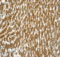 Immunohistochemistry (Formalin/PFA-fixed paraffin-embedded sections) - Anti-NDUFAF1 antibody [EPR2795] - BSA and Azide free (AB247556), expandable thumbnail