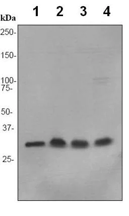 Western blot - Anti-NDUFAF1 antibody [EPR2795] - BSA and Azide free (AB247556)