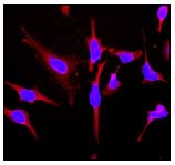 Immunocytochemistry/ Immunofluorescence - Anti-NDUFAF1 antibody [EPR2796] (AB79826)