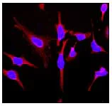 Immunocytochemistry/ Immunofluorescence - Anti-NDUFAF1 antibody [EPR2796] (AB79826)