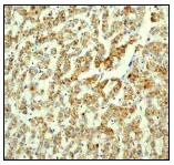 Immunohistochemistry (Formalin/PFA-fixed paraffin-embedded sections) - Anti-NDUFAF1 antibody [EPR2796] (AB79826)