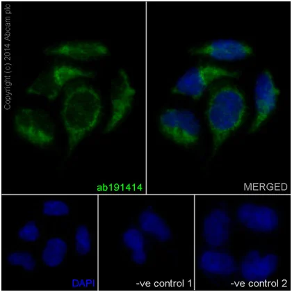Immunocytochemistry/ Immunofluorescence - Anti-NDUFAF4 antibody [EPR15931] (AB191414)