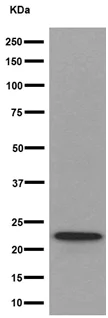 Western blot - Anti-NDUFAF4 antibody [EPR15931] - BSA and Azide free (AB251070)