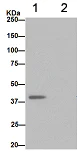 Immunoprecipitation - Anti-NDUFAF5 antibody [EPR15870] - BSA and Azide free (AB240971)