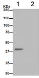 Immunoprecipitation - Anti-NDUFAF5 antibody [EPR15870] - C-terminal (ab192235), expandable thumbnail