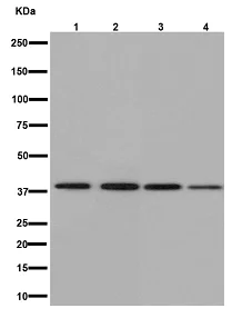 Western blot - Anti-NDUFAF5 antibody [EPR15870] - C-terminal (AB192235)