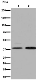 Western blot - Anti-NDUFAF5 antibody [EPR15870] - C-terminal (AB192235)