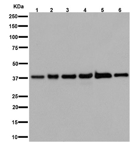 Western blot - Anti-NDUFAF5 antibody [EPR15870] - C-terminal (AB192235), expandable thumbnail