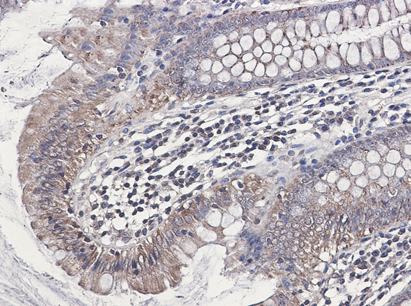 Immunohistochemistry (Formalin/PFA-fixed paraffin-embedded sections) - Anti-NDUFB1 Antibody [S04-4H3] (AB317412), expandable thumbnail