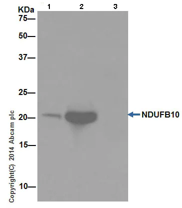 Immunoprecipitation - Anti-NDUFB10 antibody [EPR16230-47] (AB196019)