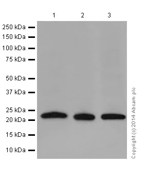 Western blot - Anti-NDUFB10 antibody [EPR16230-47] (AB196019)
