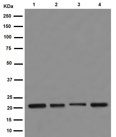 Western blot - Anti-NDUFB10 antibody [EPR16230] - BSA and Azide free (AB251116), expandable thumbnail