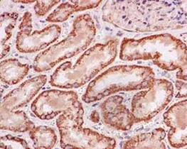 Immunohistochemistry (Formalin/PFA-fixed paraffin-embedded sections) - Anti-NDUFB11 antibody [EPR15252] (AB183716)