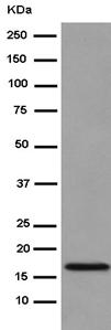 Western blot - Anti-NDUFB11 antibody [EPR15252] (AB183716), expandable thumbnail