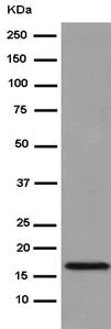 Western blot - Anti-NDUFB11 antibody [EPR15252] (AB183716)