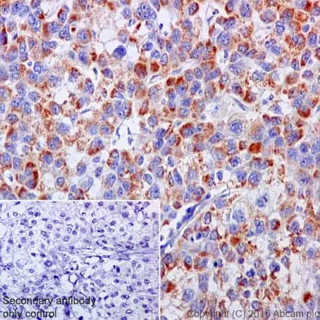 Immunohistochemistry (Formalin/PFA-fixed paraffin-embedded sections) - Anti-NDUFB3 antibody [EPR15571] (AB202585)