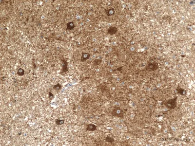 Immunohistochemistry (Formalin/PFA-fixed paraffin-embedded sections) - Anti-NDUFB4 antibody [17G3D9E12] (AB110243)