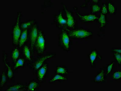 Immunocytochemistry/ Immunofluorescence - Anti-NDUFB5 antibody (AB230215)