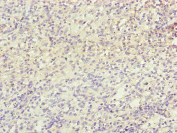 Immunohistochemistry (Formalin/PFA-fixed paraffin-embedded sections) - Anti-NDUFB5 antibody (AB230215)