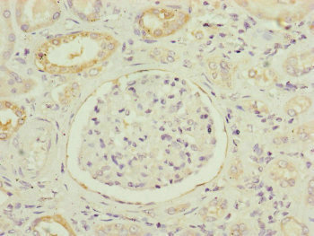 Immunohistochemistry (Formalin/PFA-fixed paraffin-embedded sections) - Anti-NDUFB5 antibody (AB230215)
