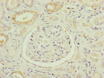 Immunohistochemistry (Formalin/PFA-fixed paraffin-embedded sections) - Anti-NDUFB5 antibody (AB230215)