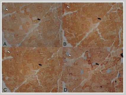 Immunohistochemistry (Frozen sections) - Anti-NDUFB8 antibody [20E9DH10C12] (AB110242), expandable thumbnail