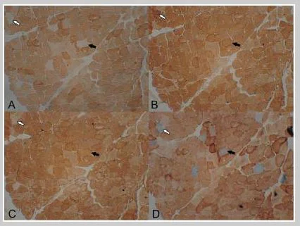 Immunohistochemistry (Frozen sections) - Anti-NDUFB8 antibody [20E9DH10C12] (AB110242)