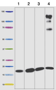 Western blot - Anti-NDUFB8 antibody [20E9DH10C12] (AB110242), expandable thumbnail