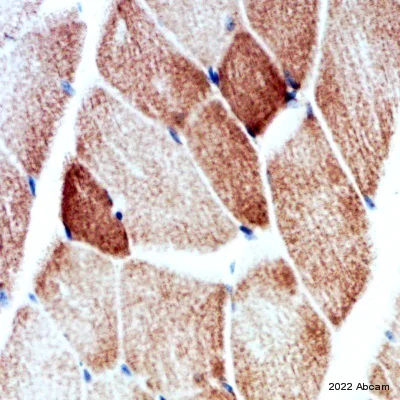 Immunohistochemistry (Formalin/PFA-fixed paraffin-embedded sections) - Anti-NDUFB8 antibody [EPR15961] (AB192878)