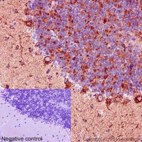 Immunohistochemistry (Formalin/PFA-fixed paraffin-embedded sections) - Anti-NDUFB8 antibody [EPR15961] - BSA and Azide free (AB251160)