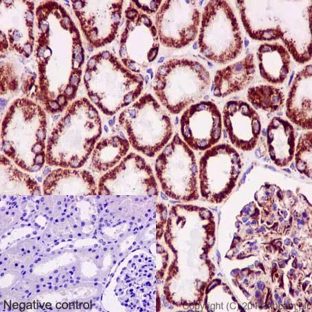 Immunohistochemistry (Formalin/PFA-fixed paraffin-embedded sections) - Anti-NDUFB8 antibody [EPR15961] - BSA and Azide free (AB251160)