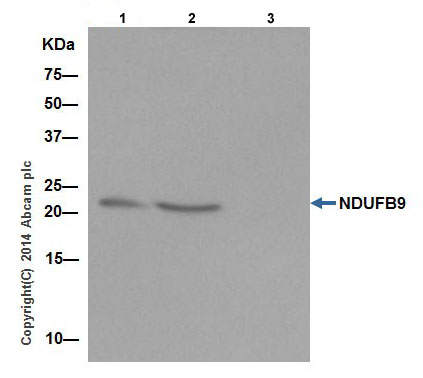 Immunoprecipitation - Anti-NDUFB9 antibody [EPR15955-78] (ab200198), expandable thumbnail